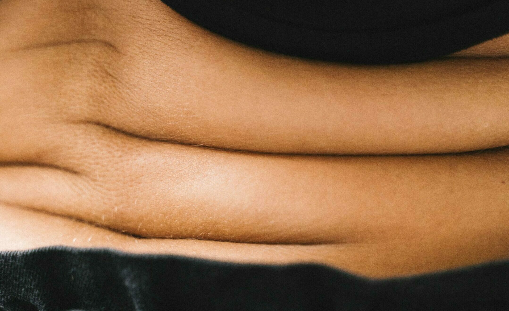 Photographie du ventre d'une femme présentant un relâchement cutané