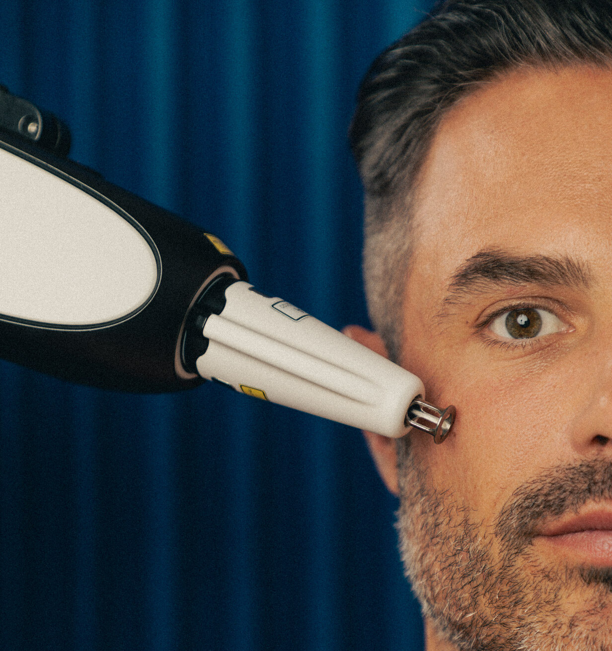 Portrait d'une homme de 35 ans recevant un traitement par laser pour traiter des cicatrices d'acné