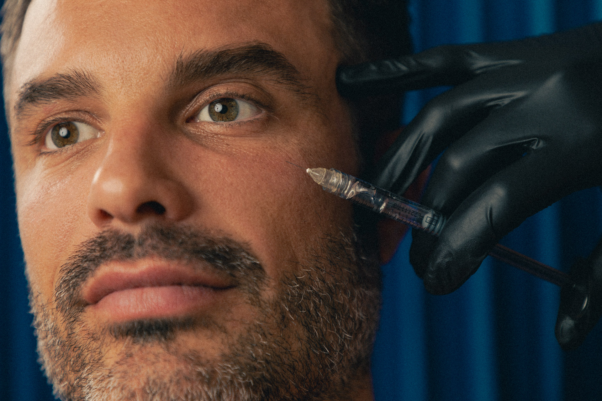 Photographie d'une homme de 35 ans recevant une injection d'acide hyaluronique dans le cerne