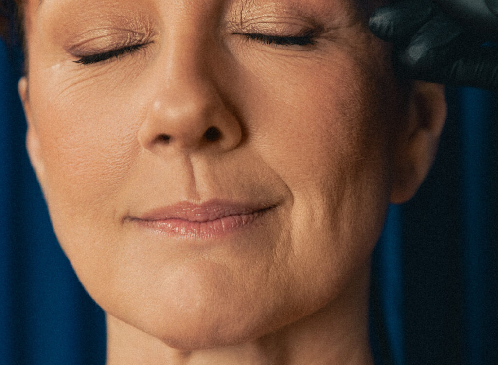 Relâchement cutané du visage